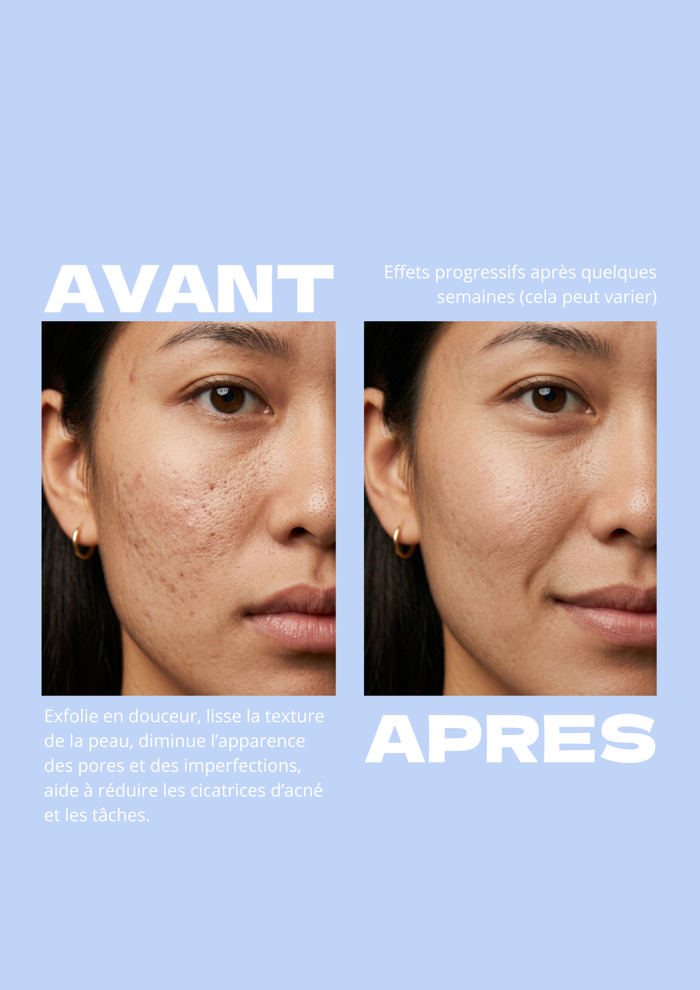 Peel. Concentré exfoliant